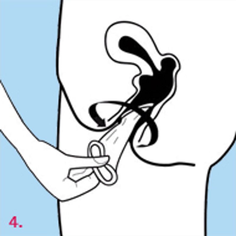 Female Condom Femidom 3 Piece - Four Seasons